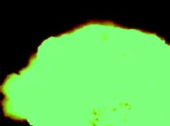 my therapy involves intense wrestling sessions