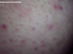 Dicknastytheillest is on one! Nothing but skin, cock, and bones!