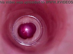 Wow, watch the internal camera capture deep male ejaculation in female insemination!