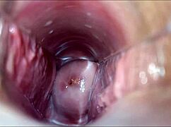 i have a vaginal orgasm with speculum, so intense