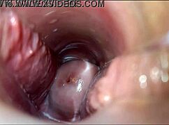 i have a vaginal orgasm with speculum, so intense