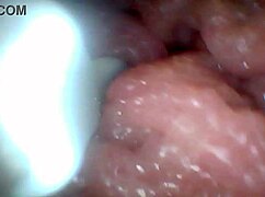 Endoscope Camera Shows Sensitive Penis Parts in Educational Video