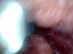 Endoscope Camera Shows Sensitive Penis Parts in Educational Video