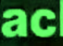 yo this amateur black teen with braces takes a hard anal pounding