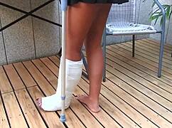 car accident cast leg, wanna touch it?