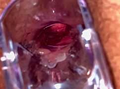 Huge BBW Mature's Hairy Ass Gaped by Anal Speculum