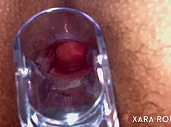 Huge BBW Mature's Hairy Ass Gaped by Anal Speculum