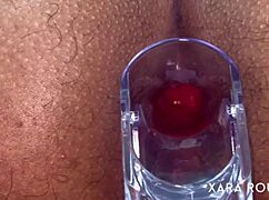 Huge BBW Mature's Hairy Ass Gaped by Anal Speculum