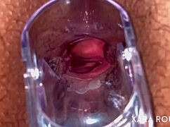 Huge BBW Mature's Hairy Ass Gaped by Anal Speculum