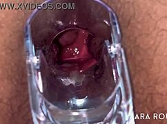 Huge BBW Mature's Hairy Ass Gaped by Anal Speculum