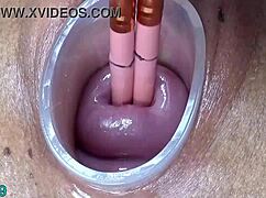 german lesbian threesome cervix play
